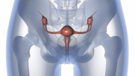 uterine prolapse