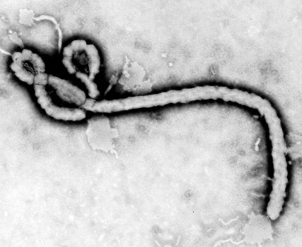 ebola virus