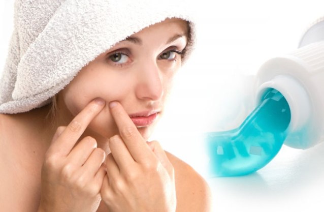 remove pimples with toothpaste
