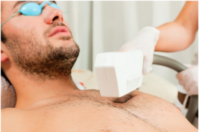 laser hair removal