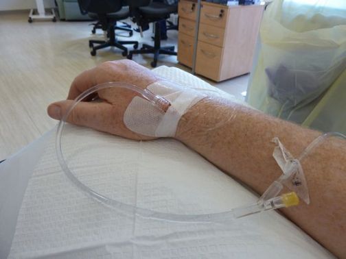 chemotherapy treatment