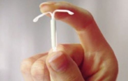 Hormonal IUD