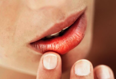 mouth lips diseases