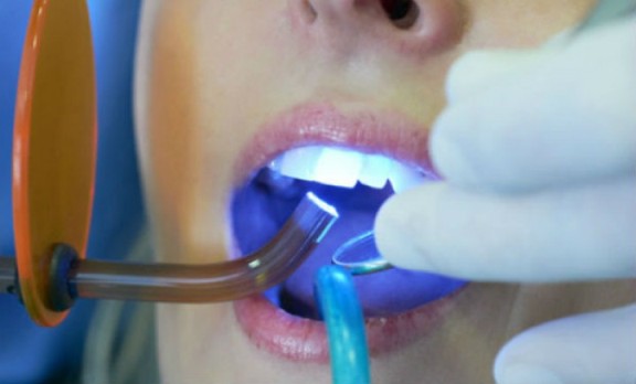 risks of teeth whitening