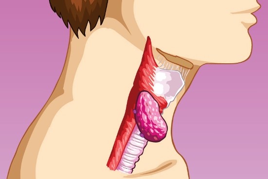 swollen lymph nodes