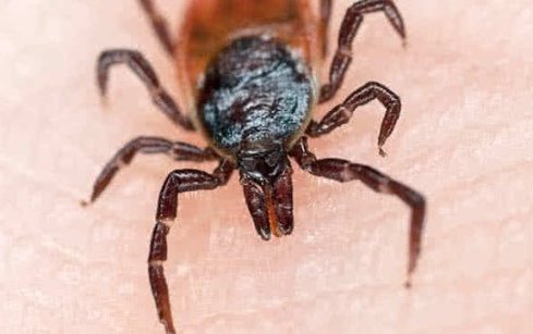 tick bite