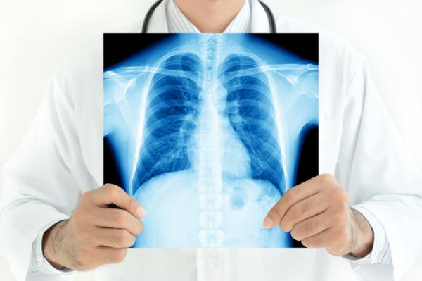 spots in the lung