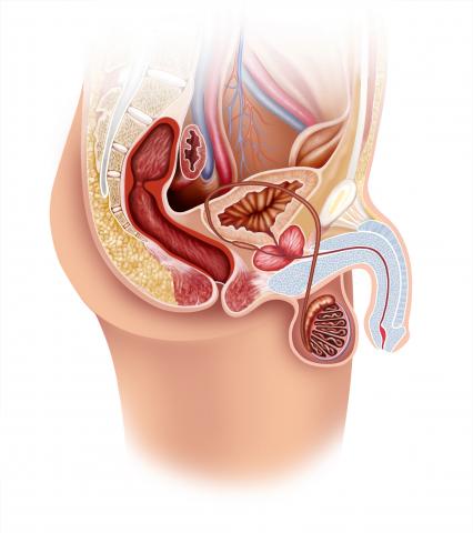 balanitis